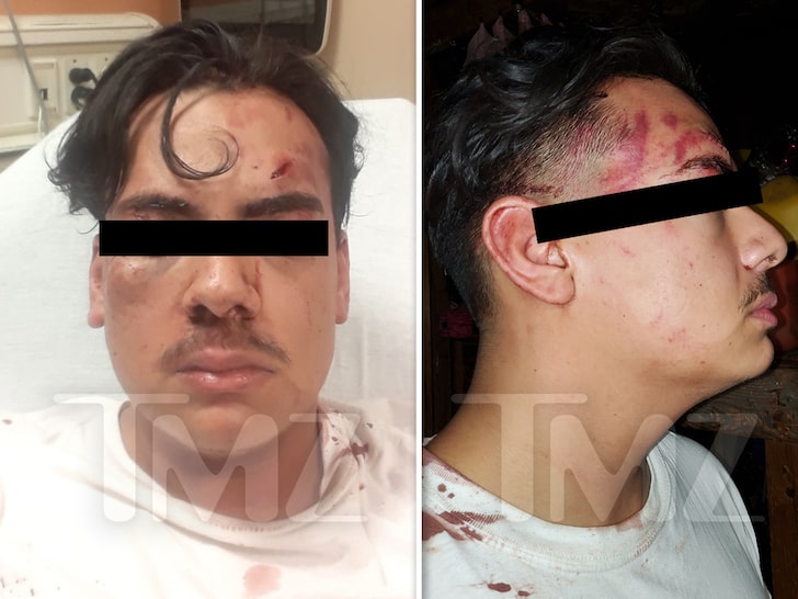 Blueface & His Crew Reportedly Caught On Camera Beating the Club Bouncer