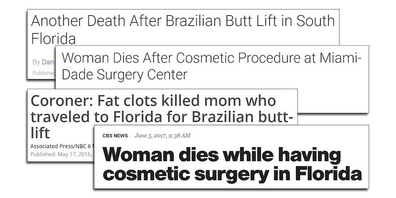 Dream Doll Says She's Undergone Four Butt Reductions Surgeries